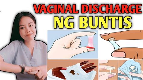 discharge kulay senyales ng buntis white mens|Vaginal discharge, tulo, 'white mens', at iba pang lumalabas sa .